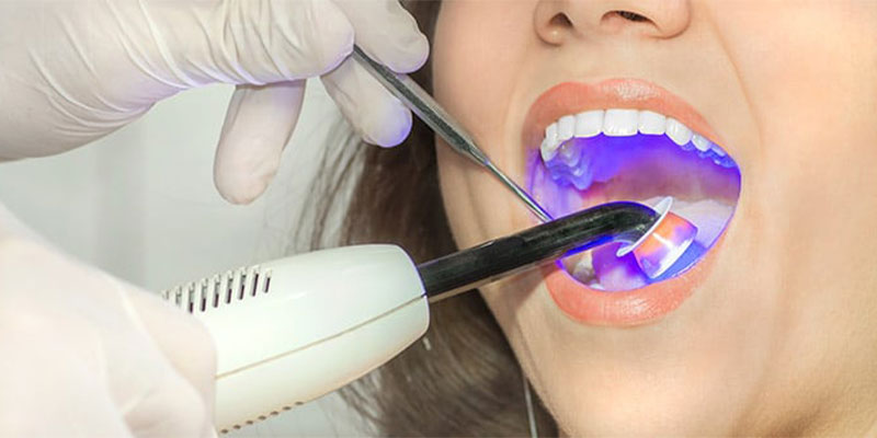 دندانپزشکی با لیزر بدون درد